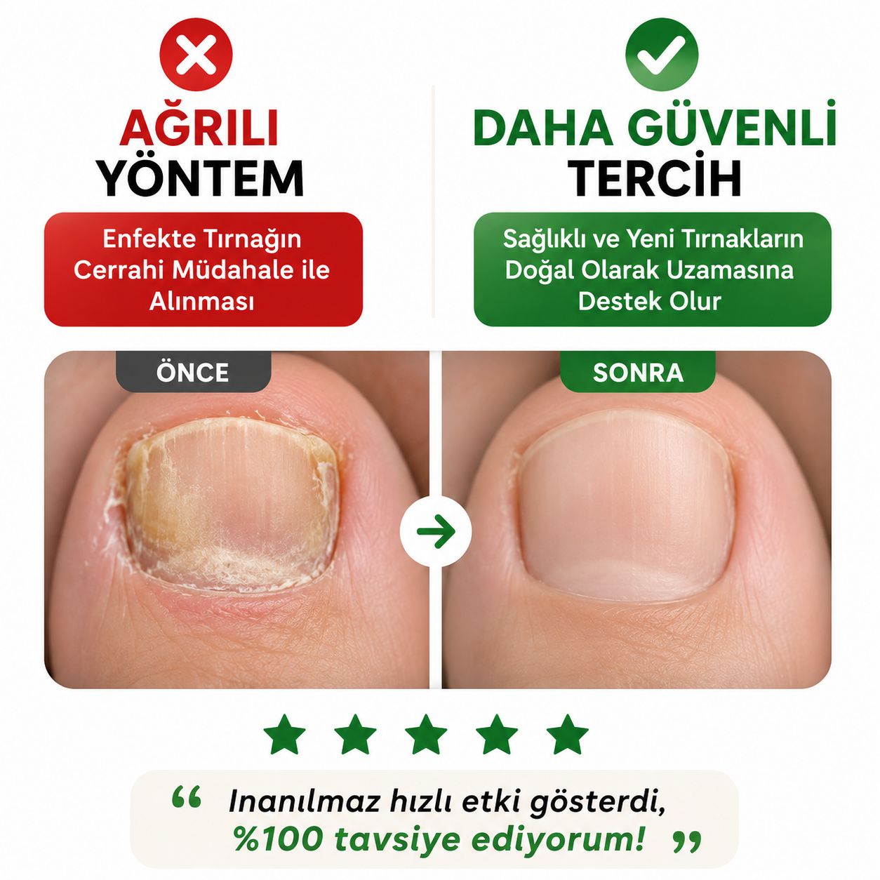 NOVENTRA LIVE® TIRNAK MANTARI TEDAVİ BANDI