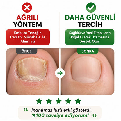 NOVENTRA LIVE® TIRNAK MANTARI TEDAVİ BANDI