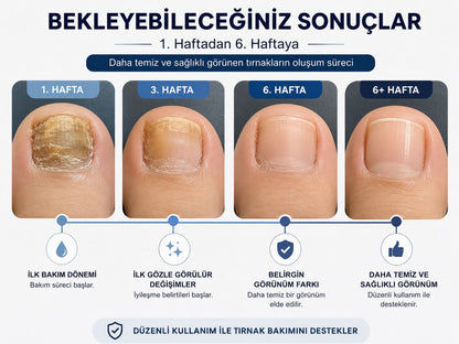 NOVENTRA LIVE® TIRNAK MANTARI TEDAVİ BANDI
